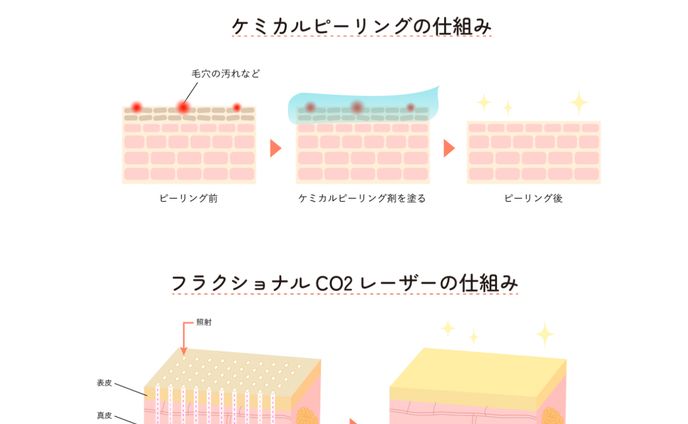 美容医療　インフォグラフィック