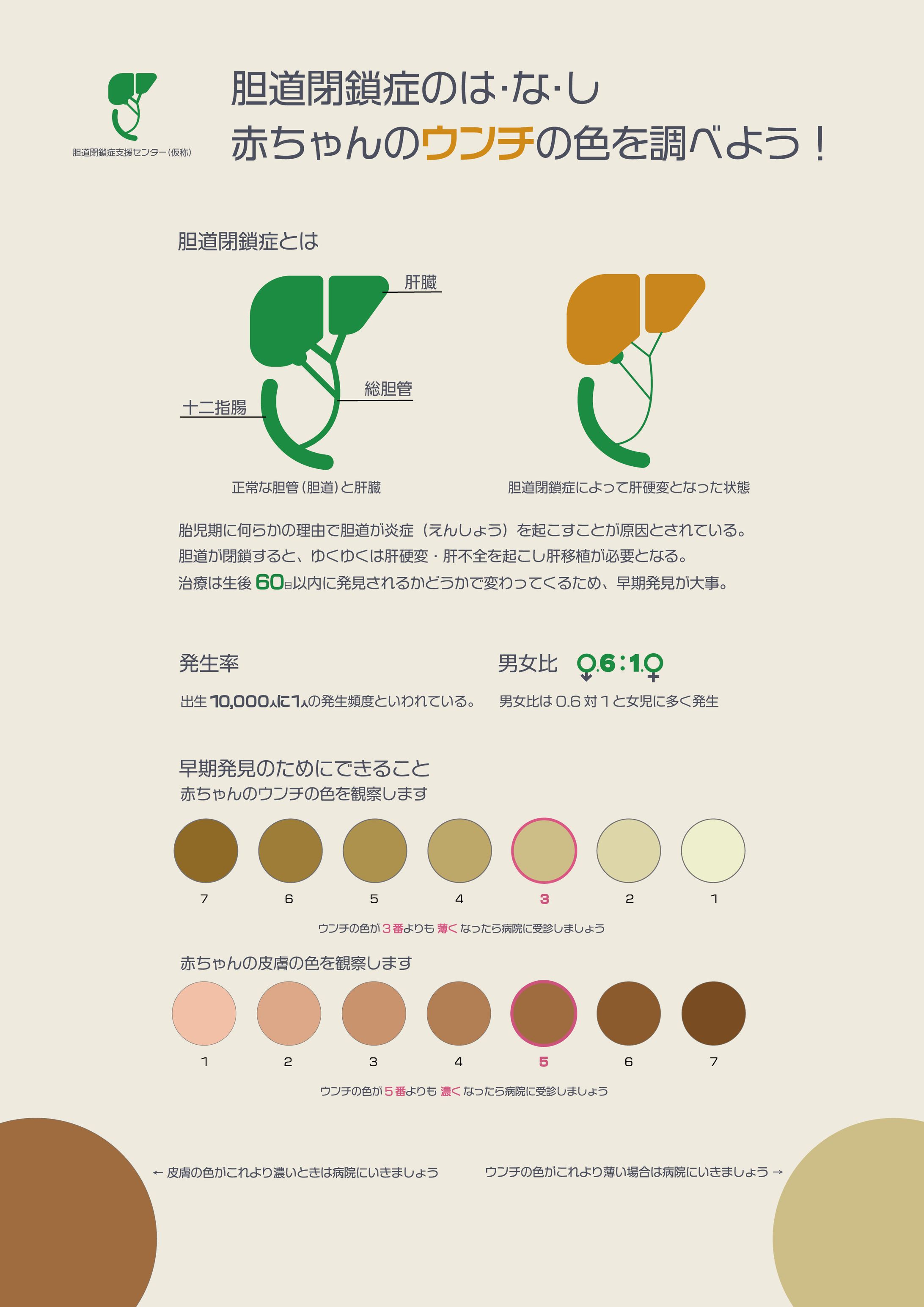 胆道閉鎖症記事-1