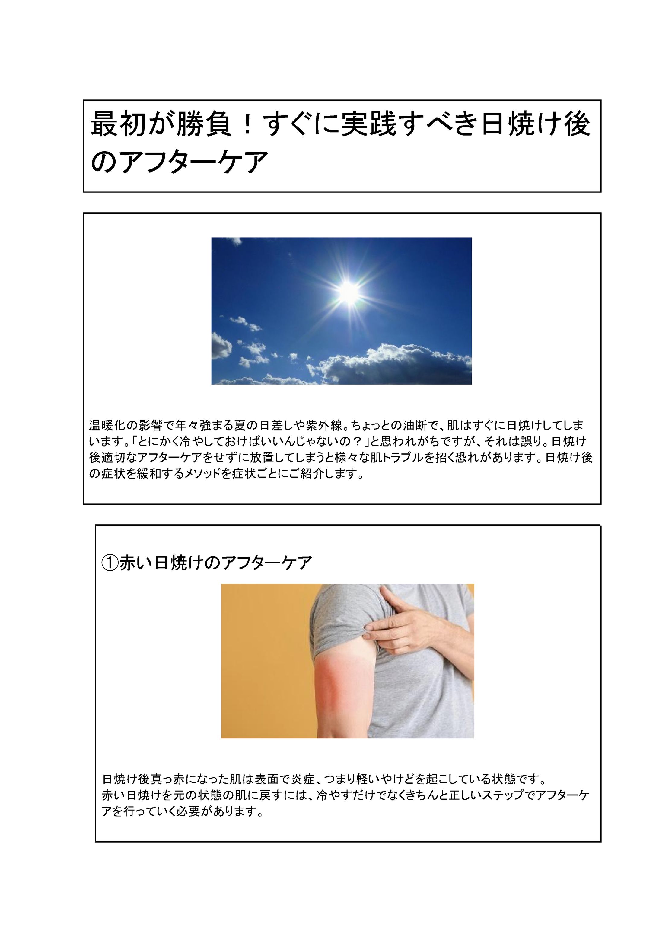 最初が勝負！すぐに実践すべき日焼け後のアフターケア-1