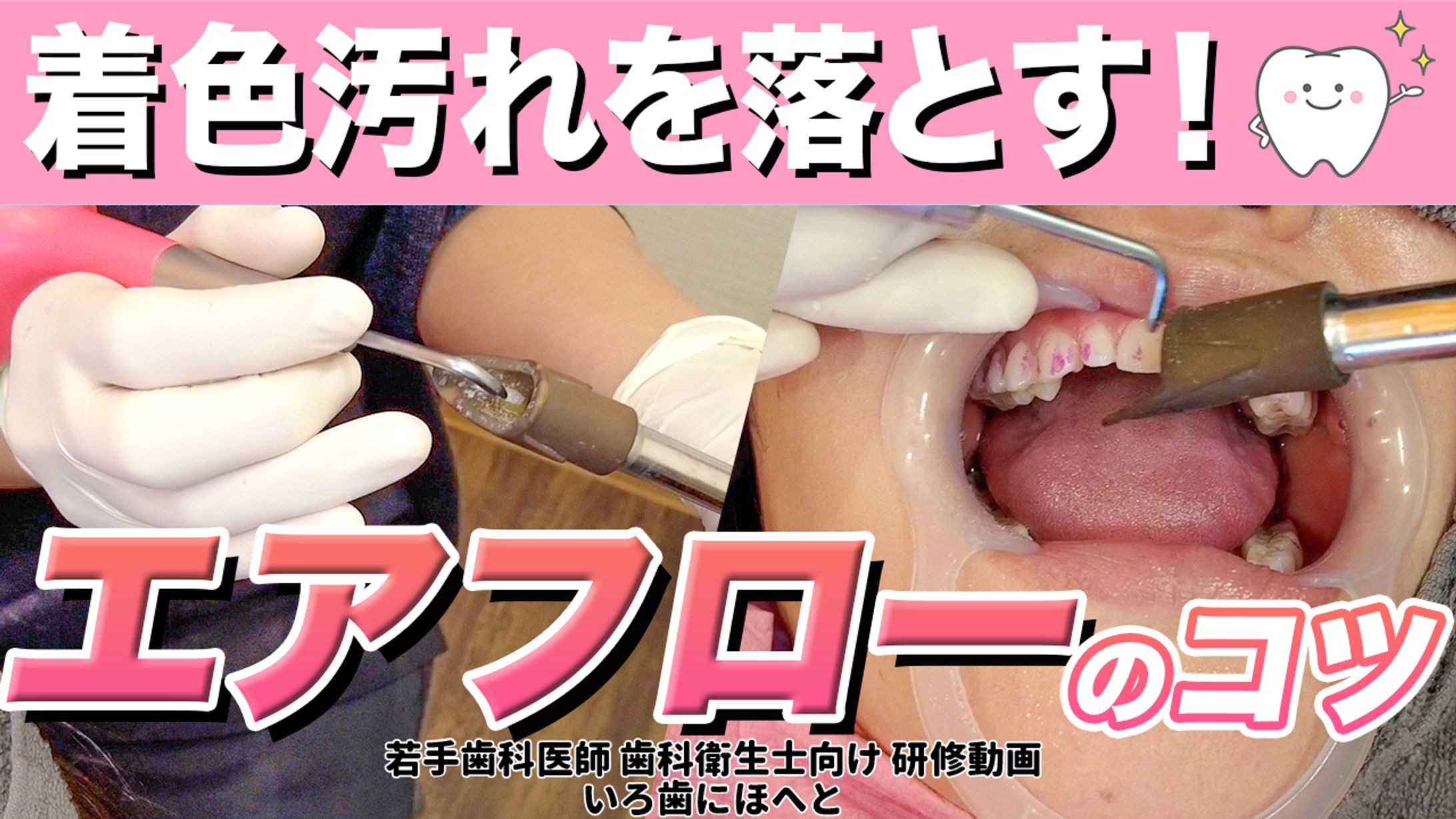 歯医者チャンネルサムネイルポートフォリオ-1