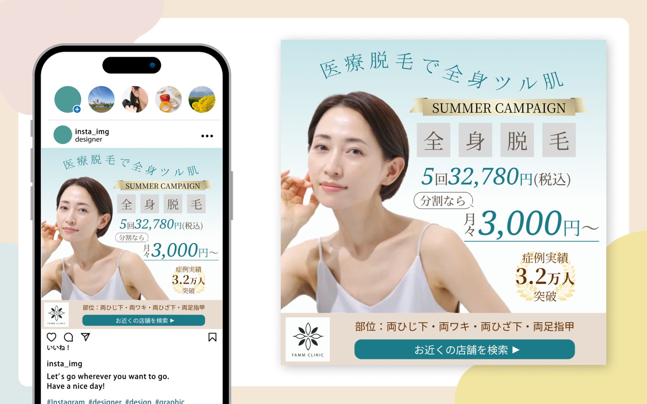 【サンプル】医療脱毛バナー　Instagram広告-1
