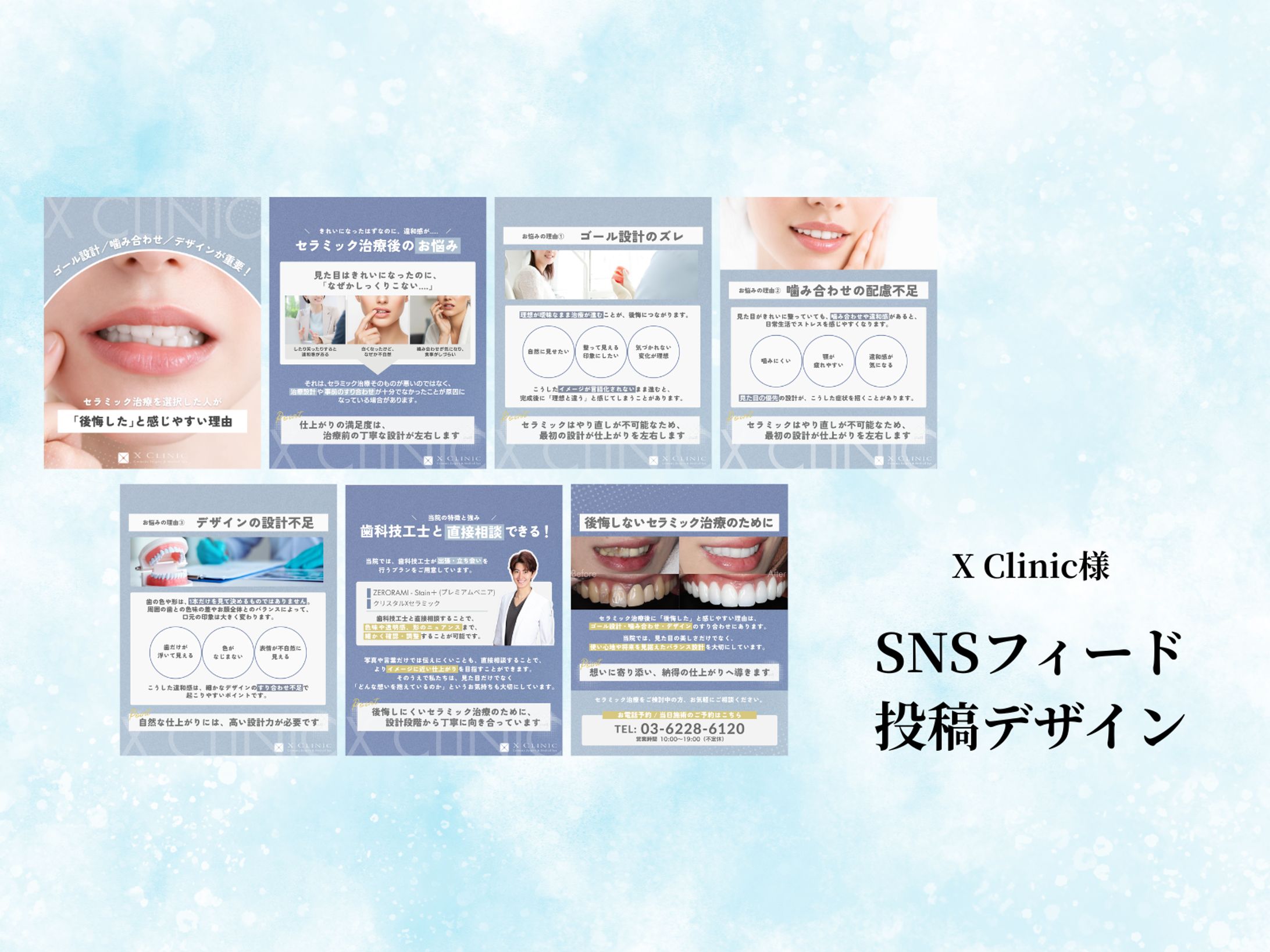 【SNSフィード投稿デザイン】　X Clinic様-1