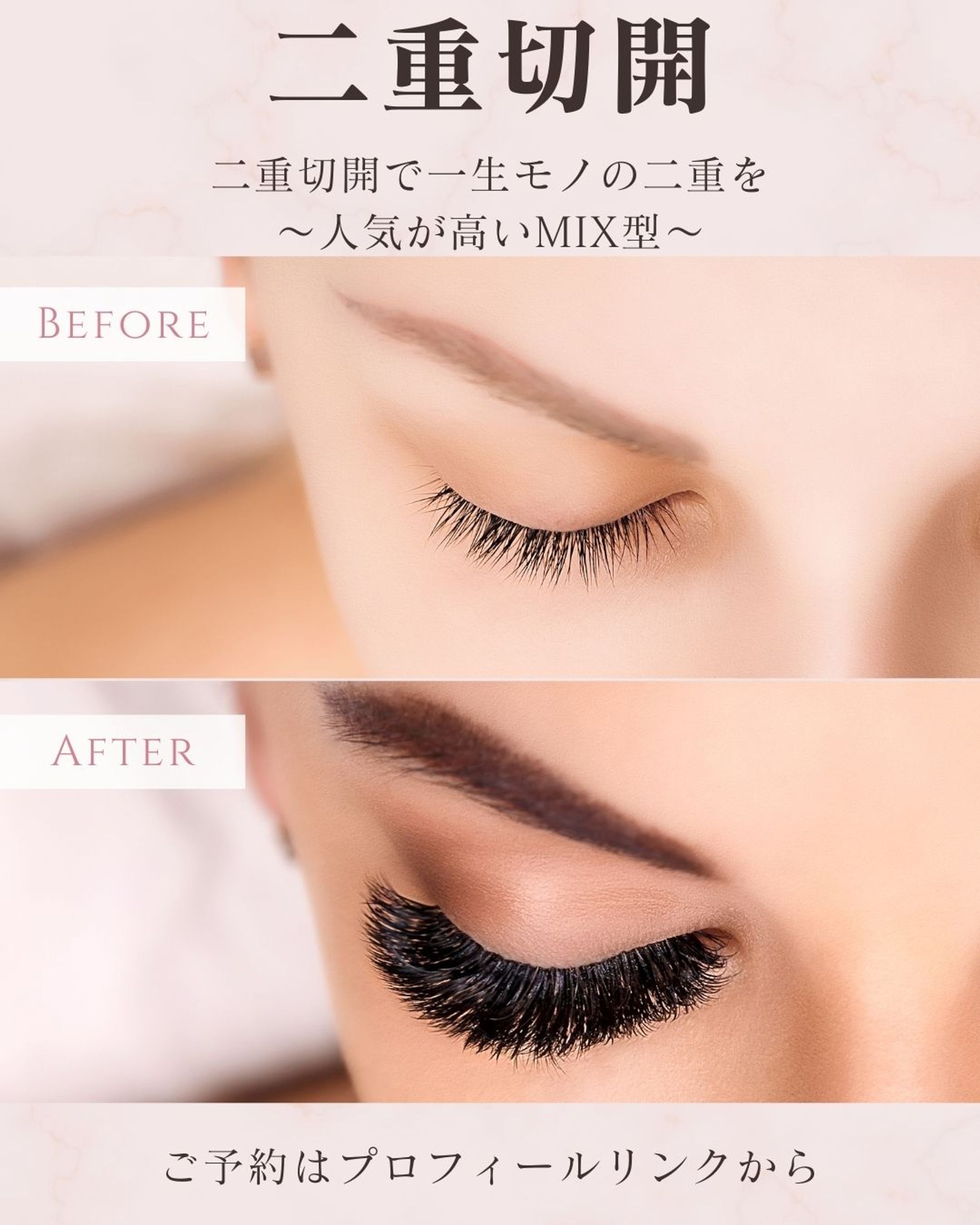 インスタ投稿　美容クリニック-1