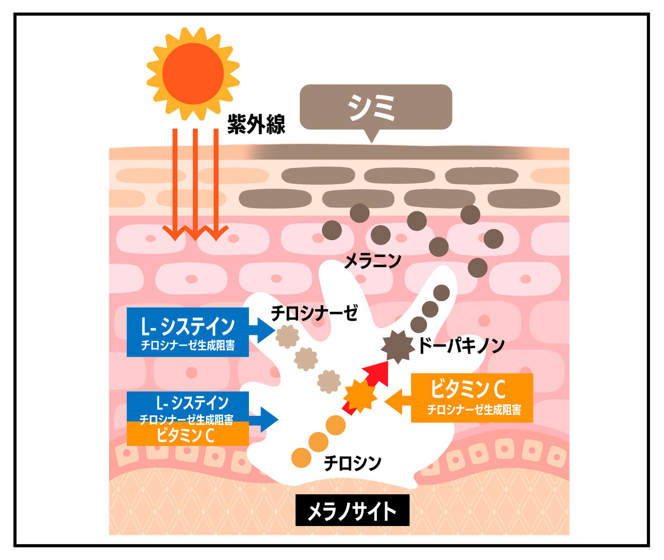 LP記事広告内　断面図作画-1