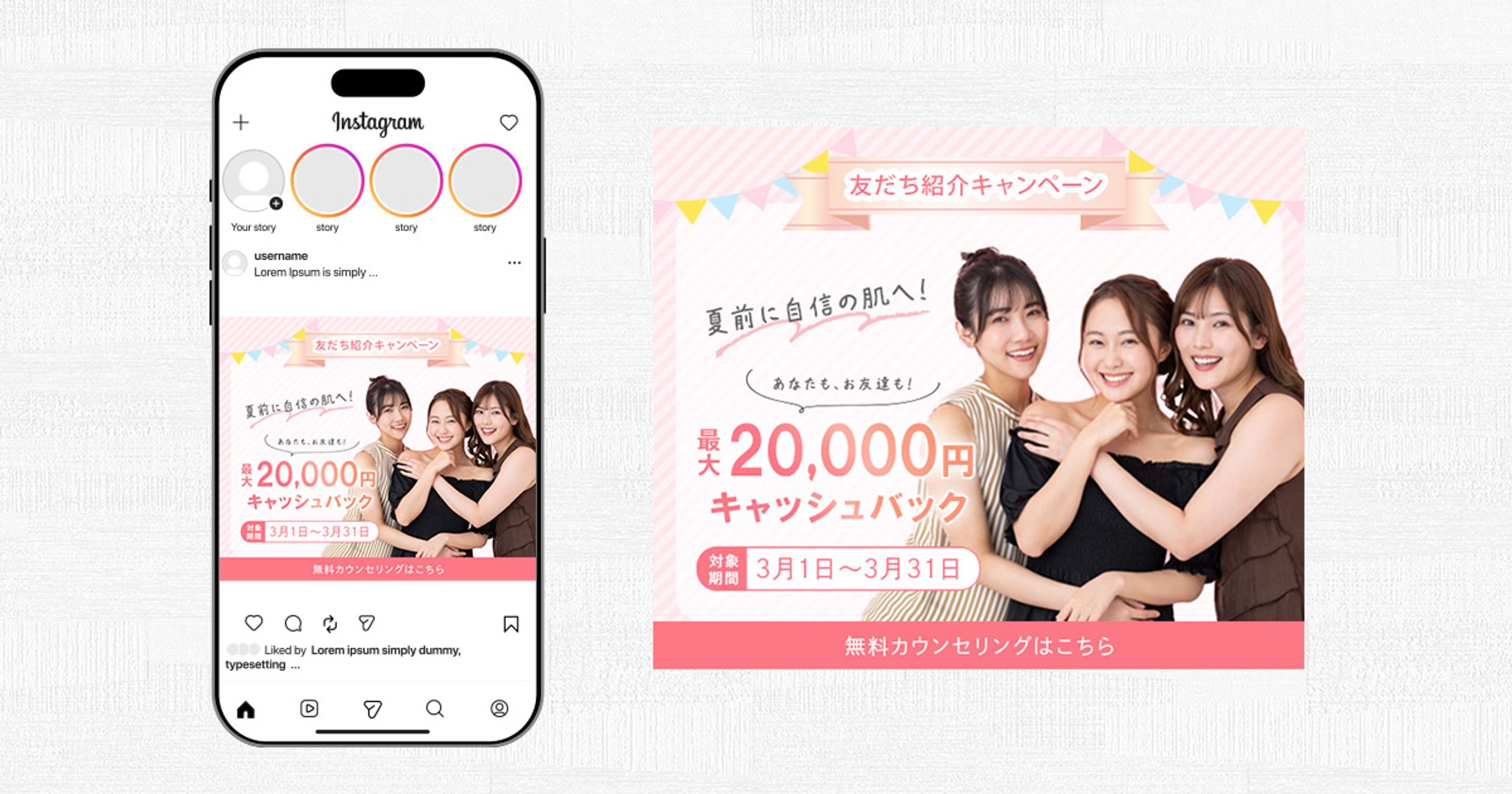 脱毛サロン広告バナー-1
