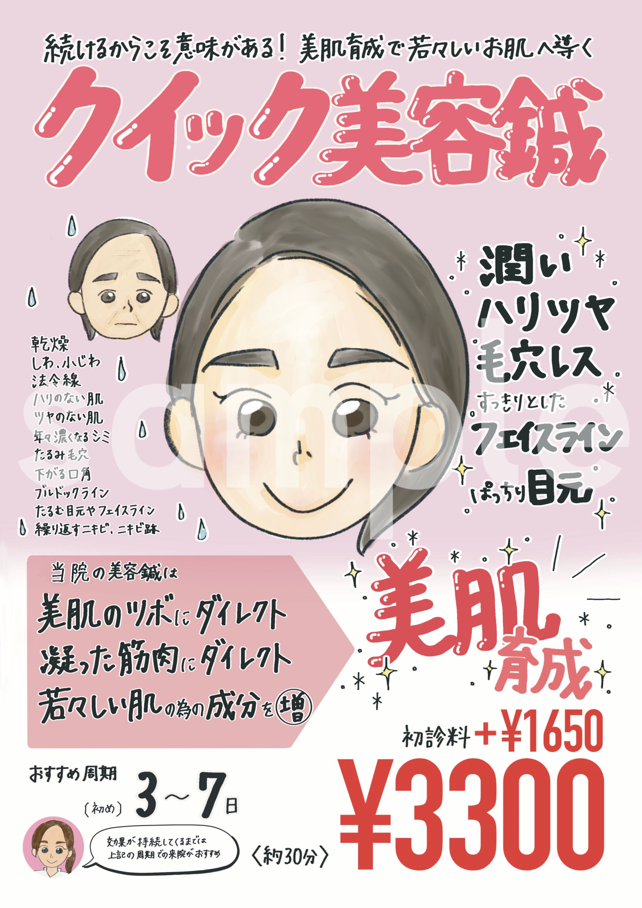 美容鍼メニュー-1