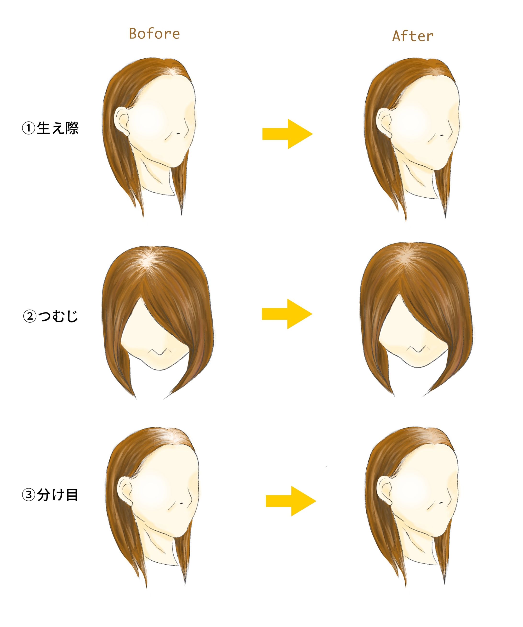 イラスト_女性の薄毛BeforeAafter-1
