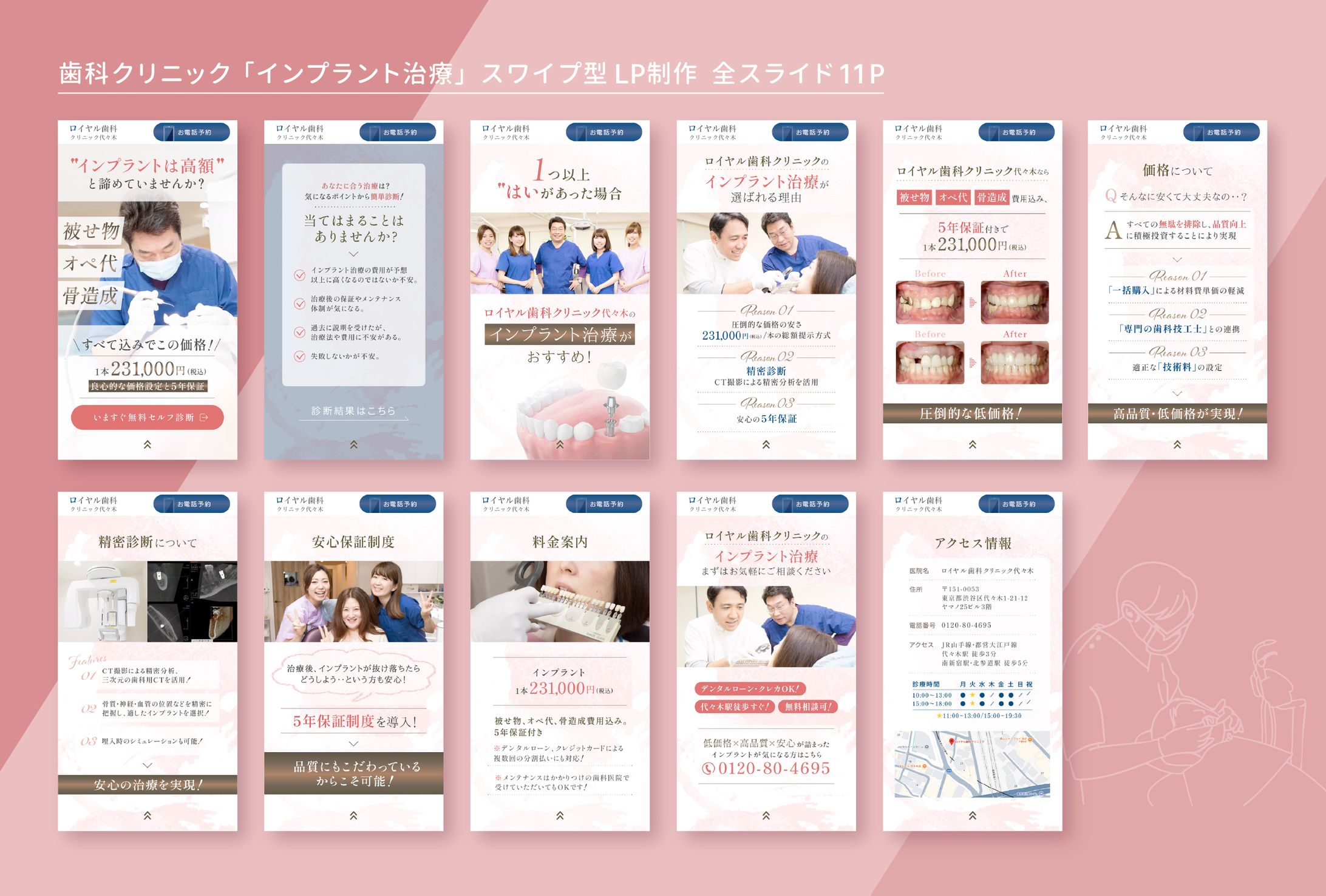 歯科クリニック「インプラント治療」スワイプ型LP 11P-1