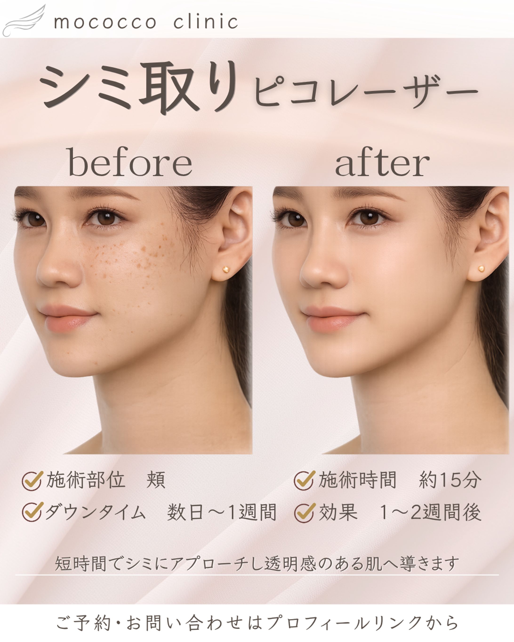 before   2シミ取り 投稿画像-1