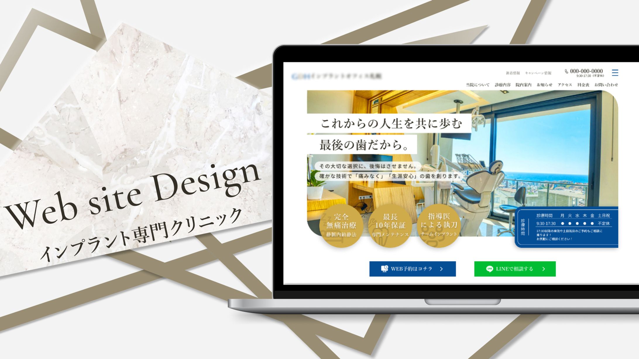 【HP】インプラントクリニックHPデザイン | 自主制作-1