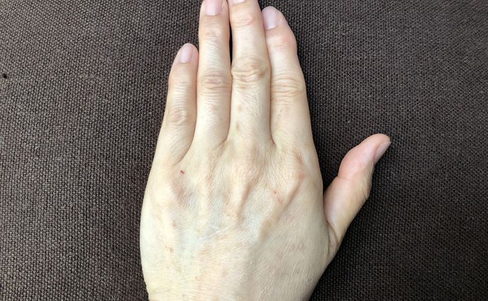 手のレタッチ