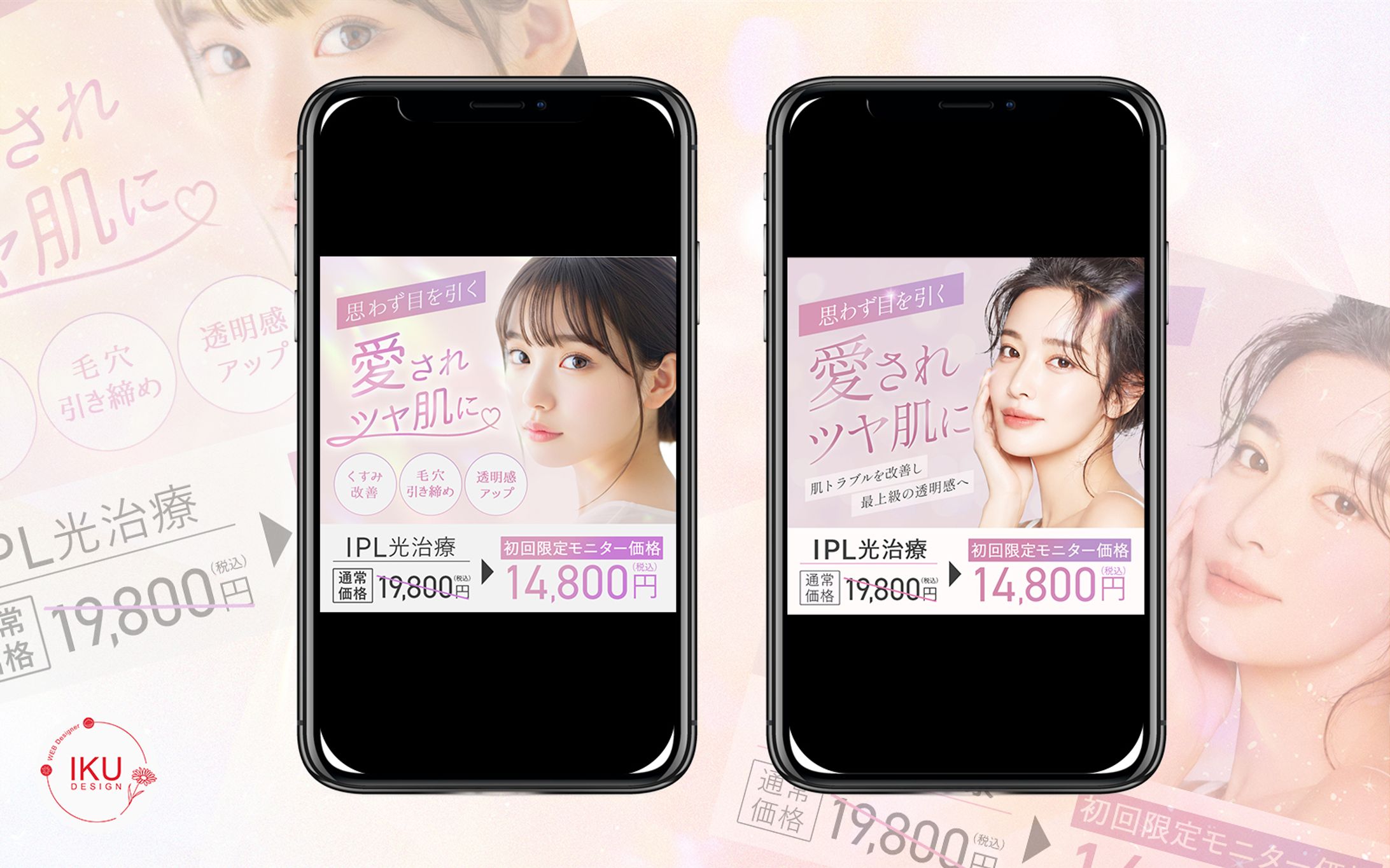 ＊自主制作　IPL光治療-1