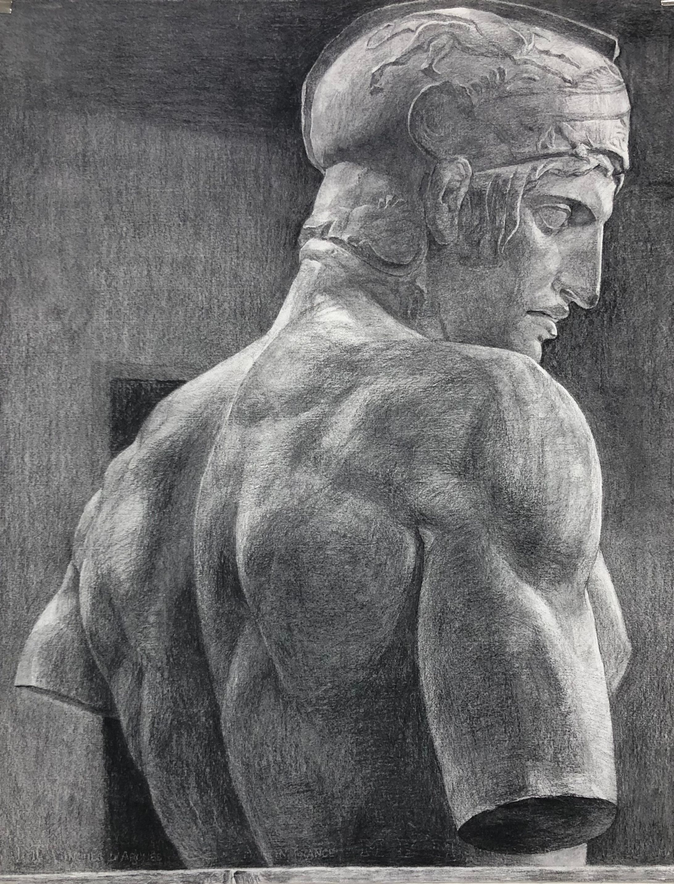 Art-1