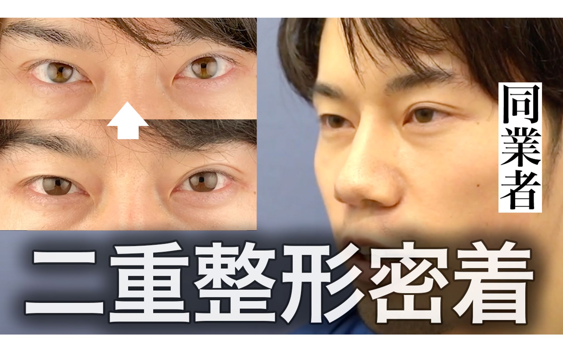 【サムネイル】美容整形-1