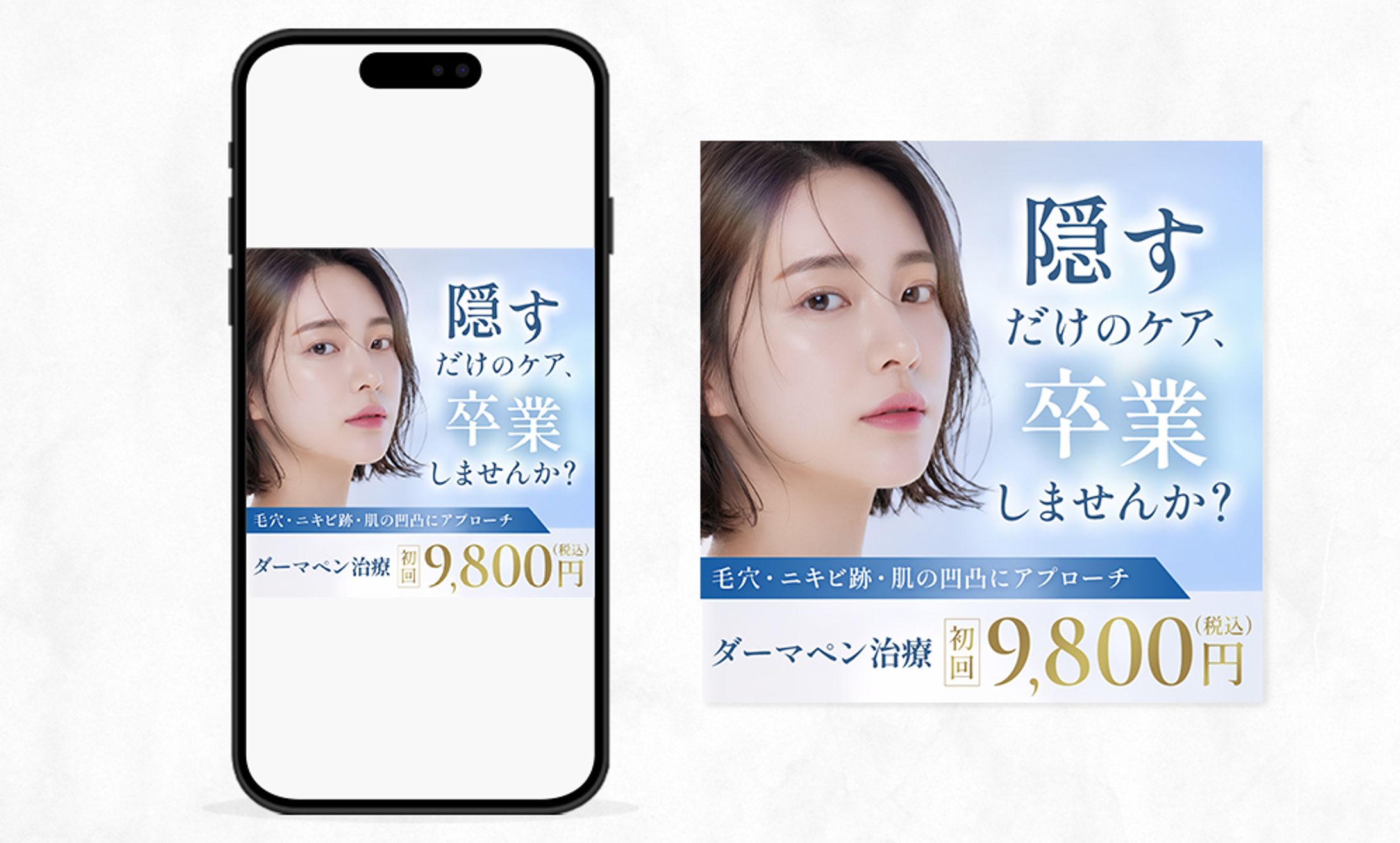 バナー:ダーマペン治療-1