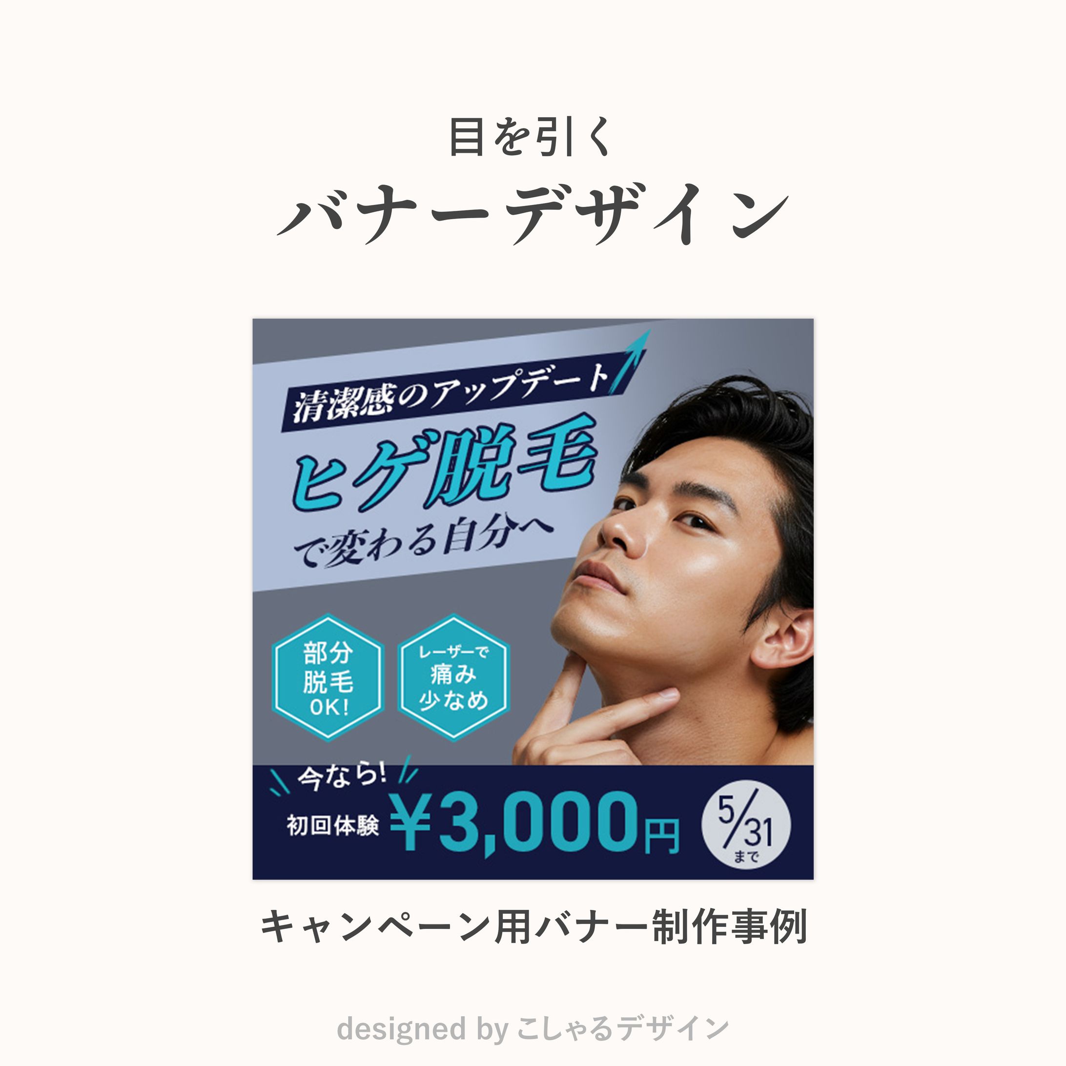 ヒゲ脱毛バナー-1