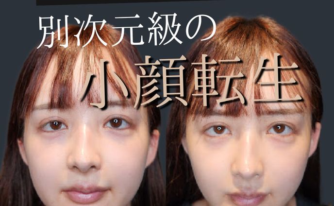 youtube漫画、instagram投稿用
