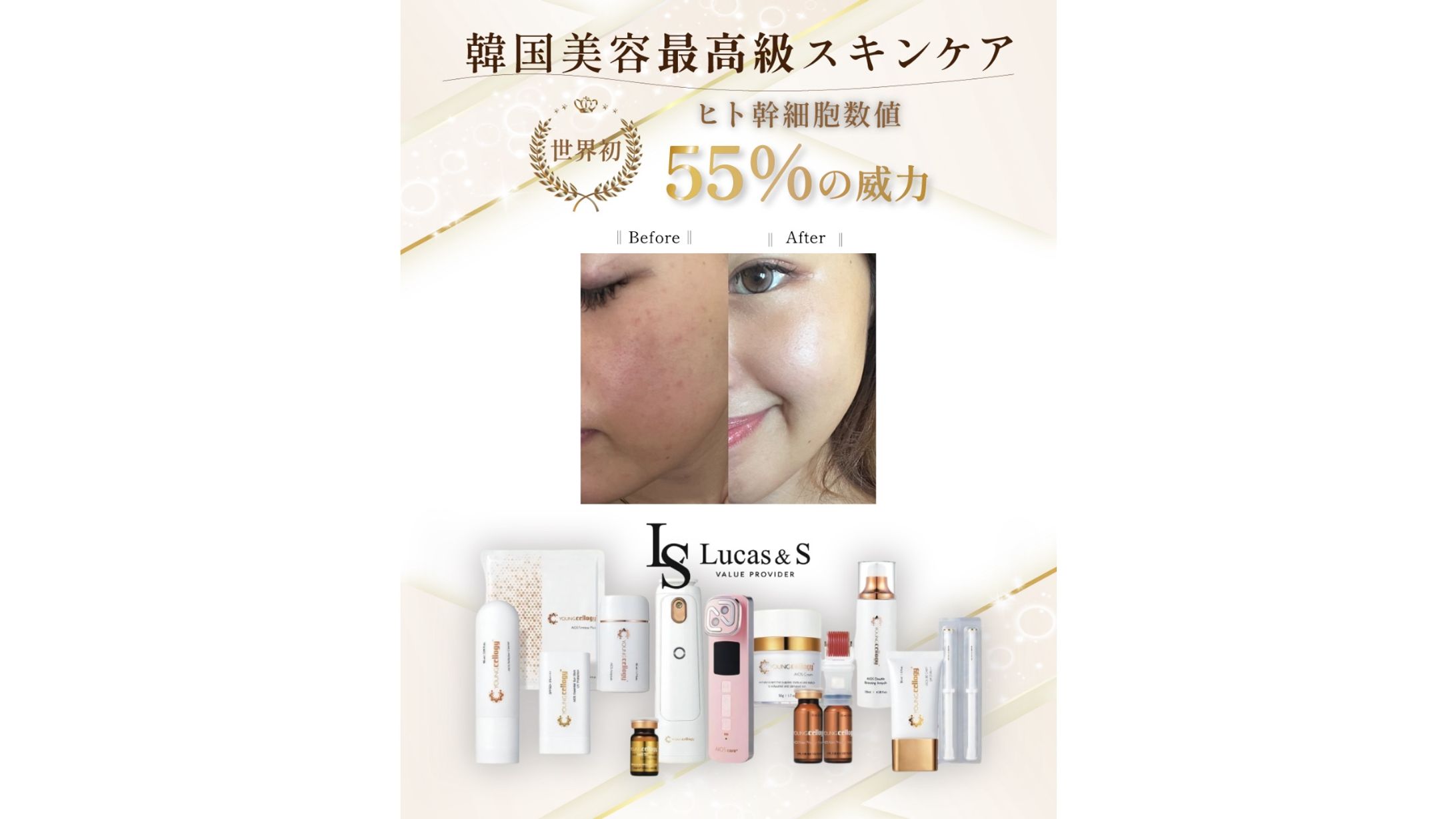 【実案件】美容サロン様SNS投稿画像　キャンペーン価格 【通常4,000円(税込)】-1