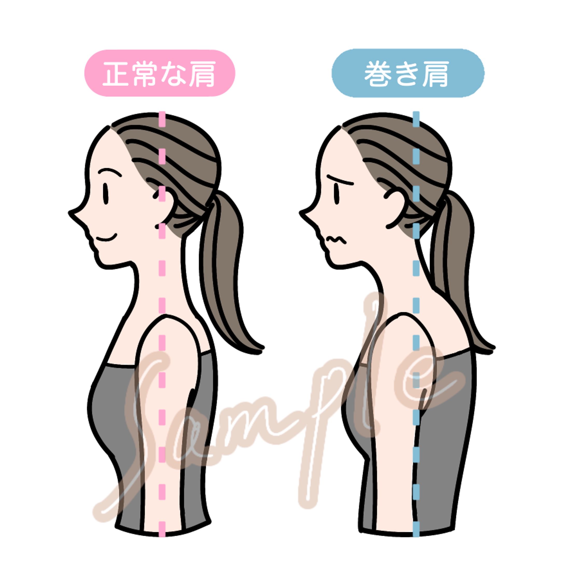 整骨院　sns用カットイラスト-1