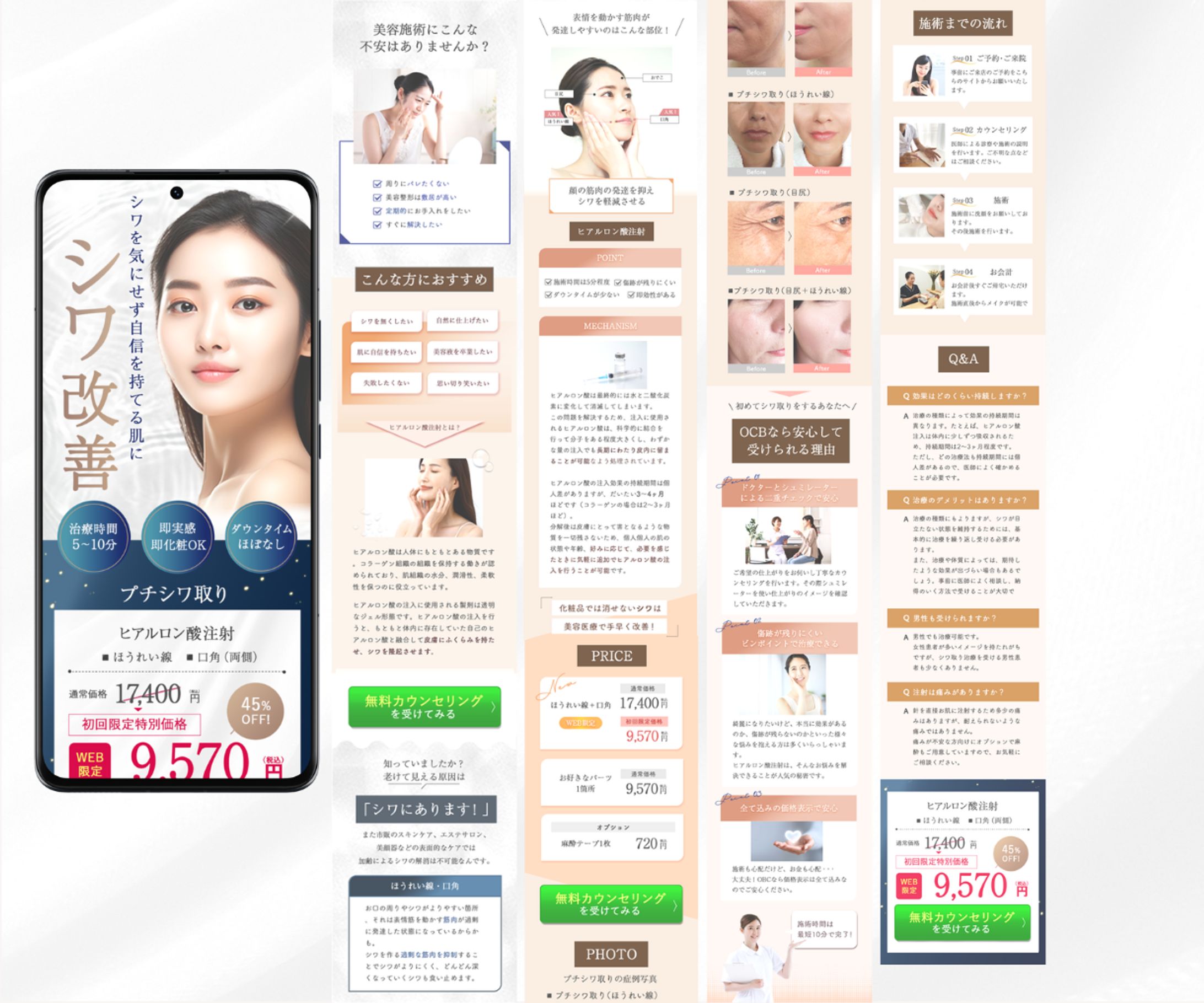 【LP】シワ改善LP-1