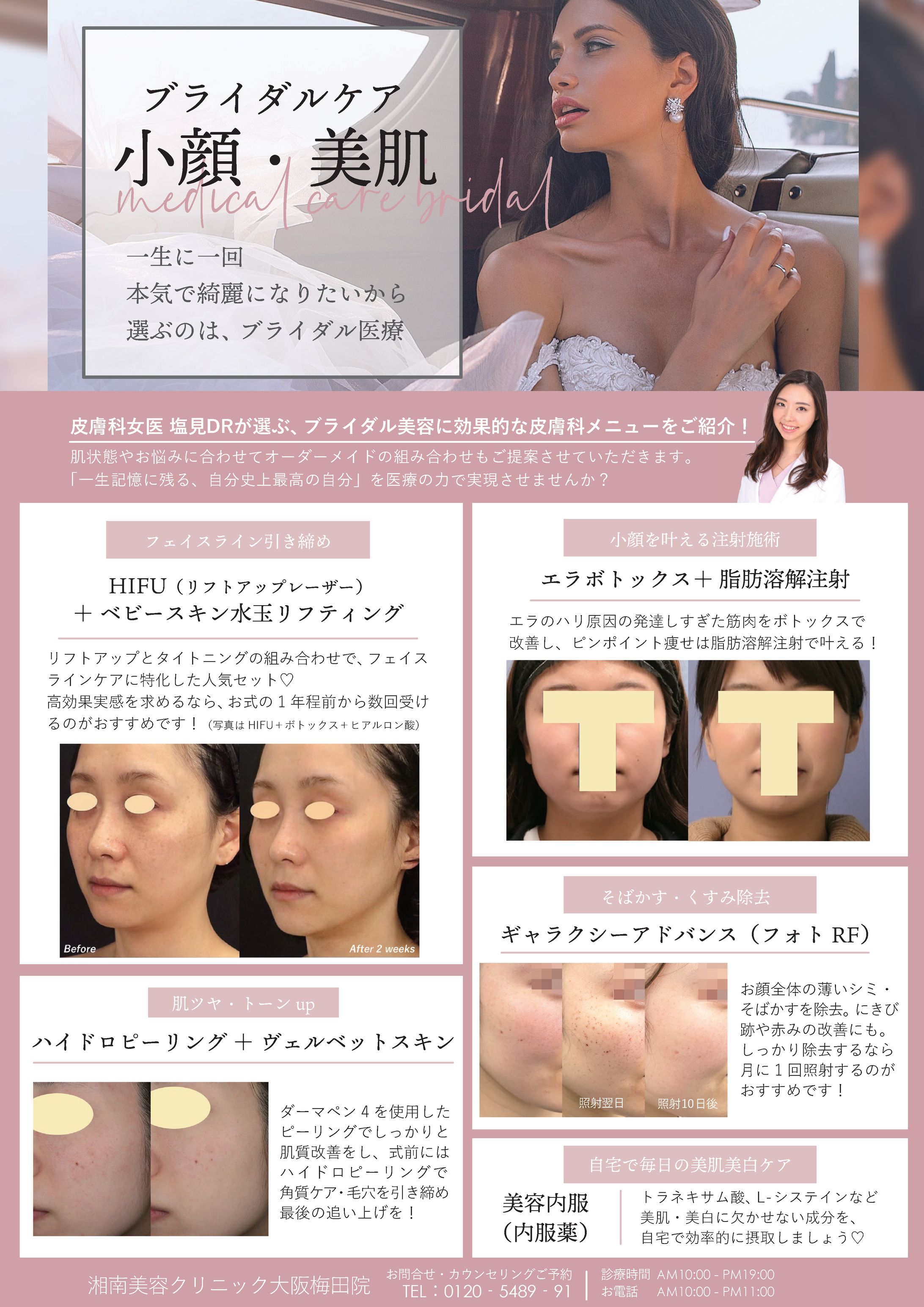 フライヤー-1
