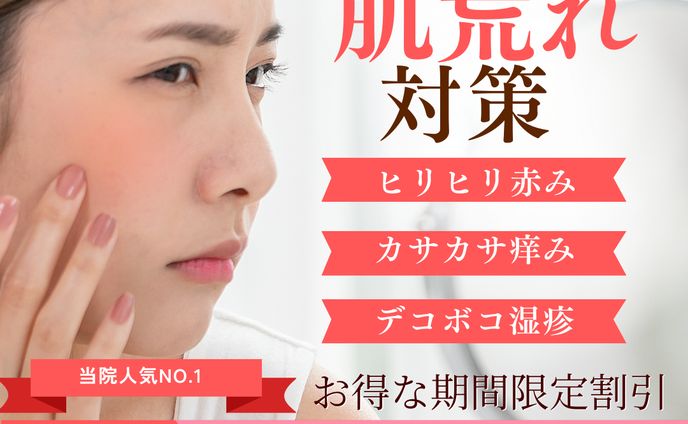 美容 スキンケア インスタグラム投稿 バナー