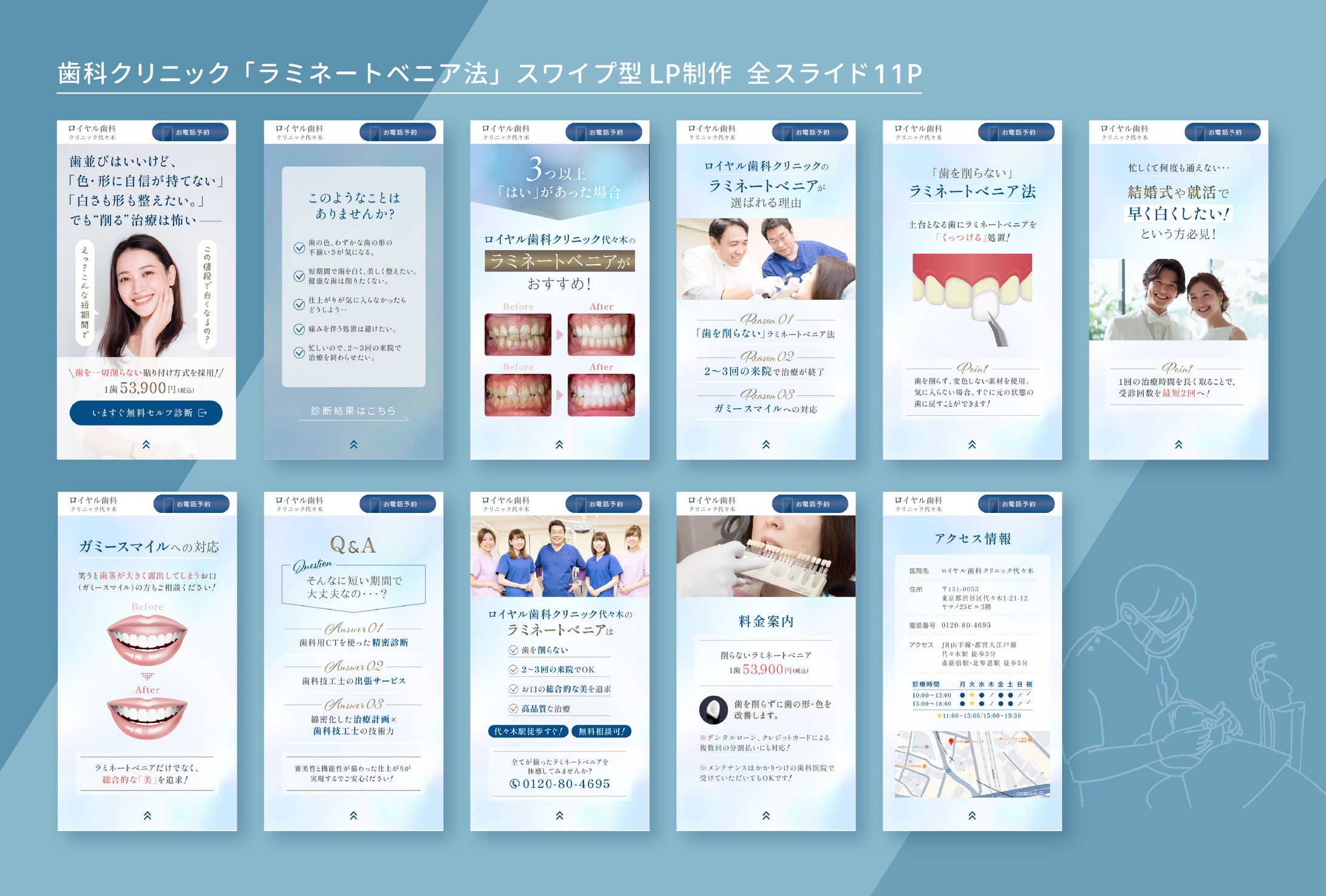 歯科クリニック「ラミネートベニア法」スワイプ型LP 11P-1