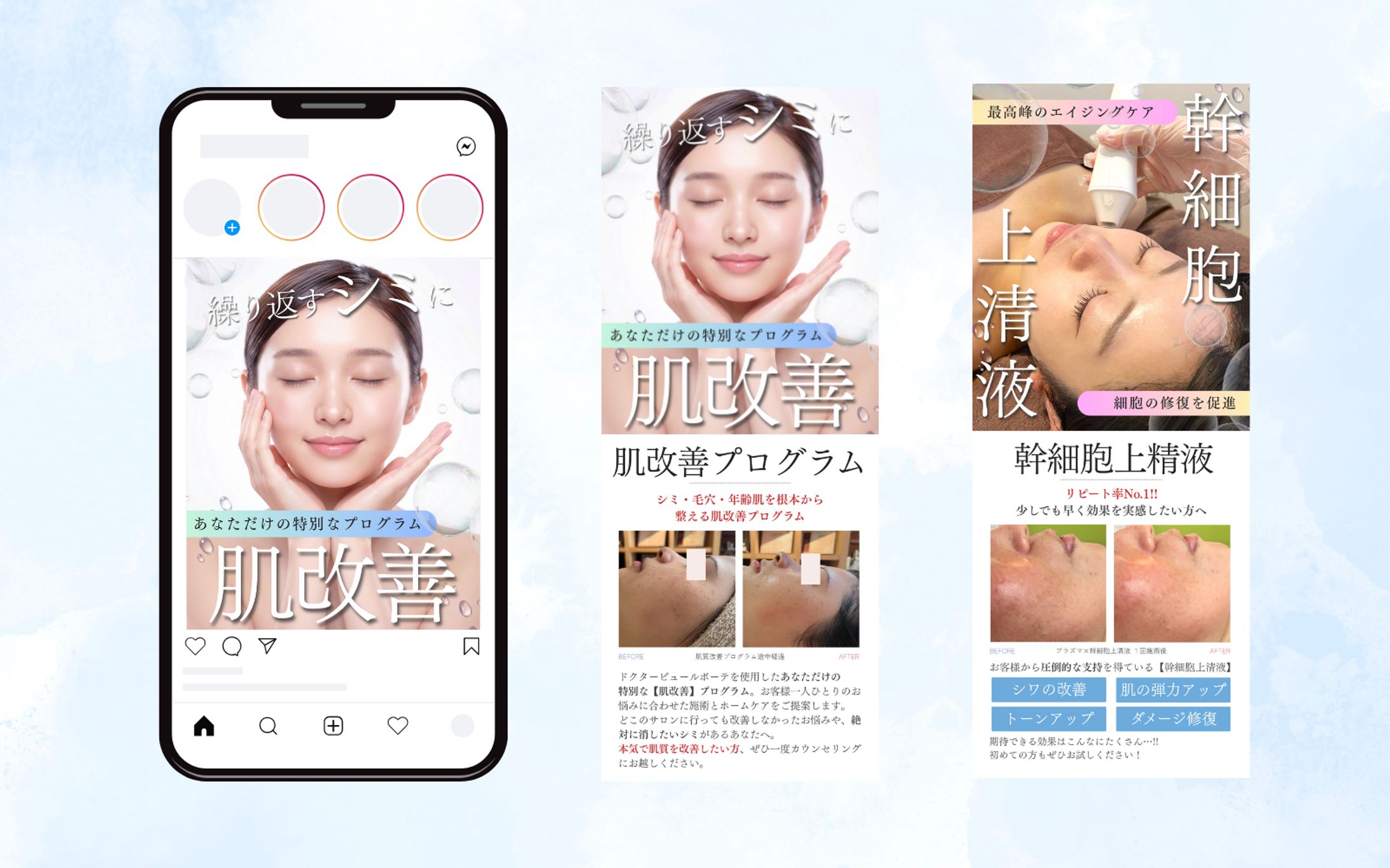  【SNS投稿デザイン】esutePICO様-1