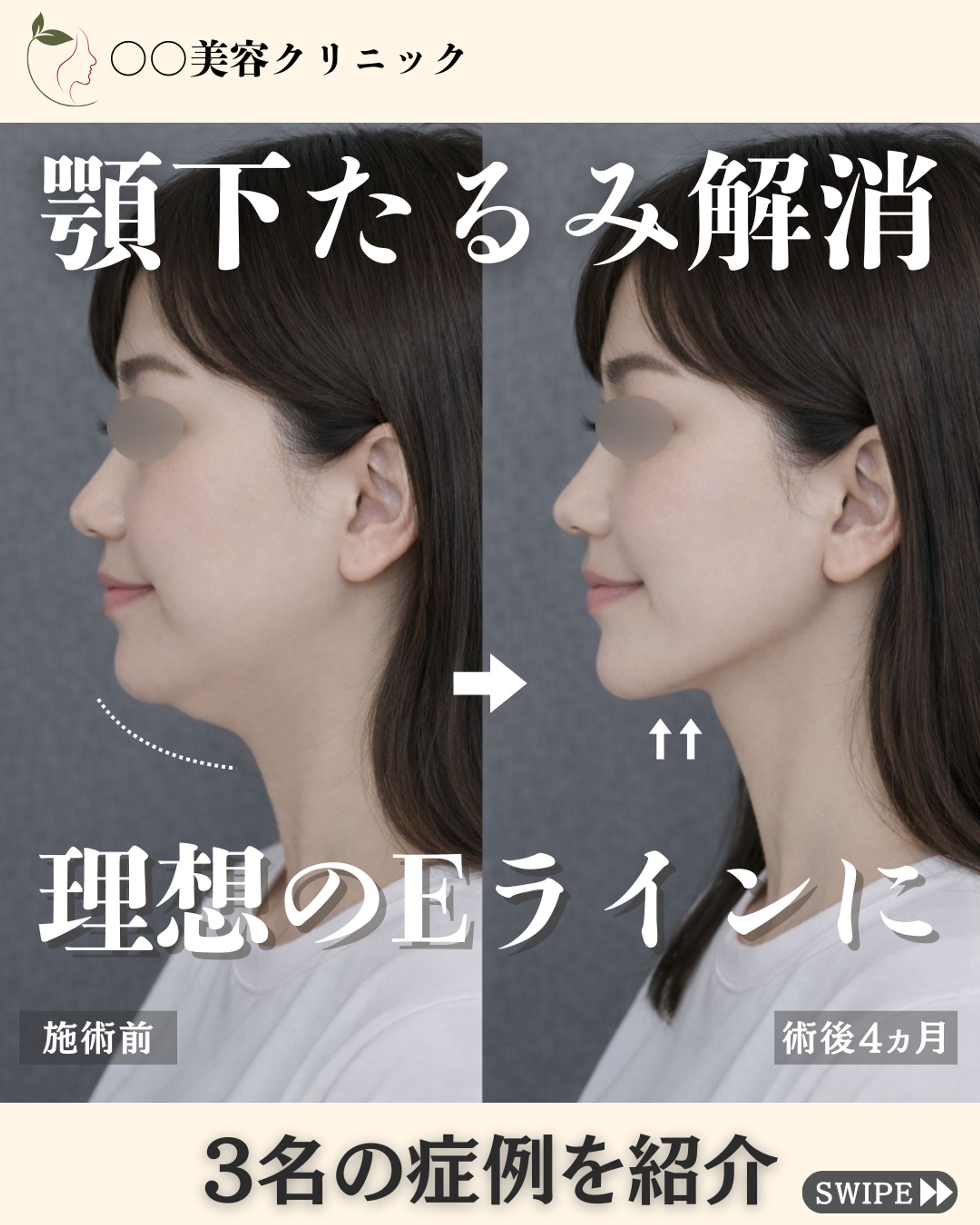 Instagramフィード投稿(美容整形クリニック)-1