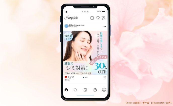 【フィード投稿画像】Instagram 美容医療