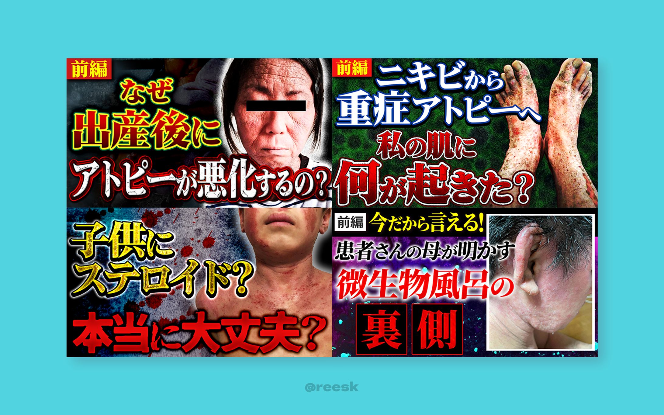 【実績】YouTubeサムネイル-1