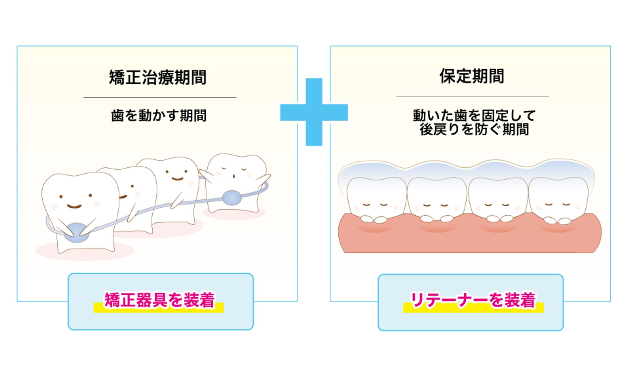 【イラスト】幼児向け歯科矯正-1