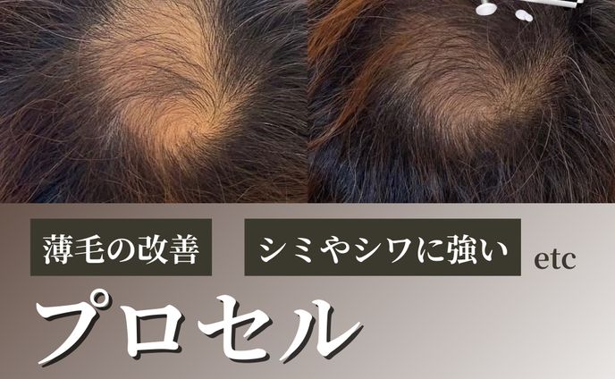 【フィード投稿事例】メンズAGA治療