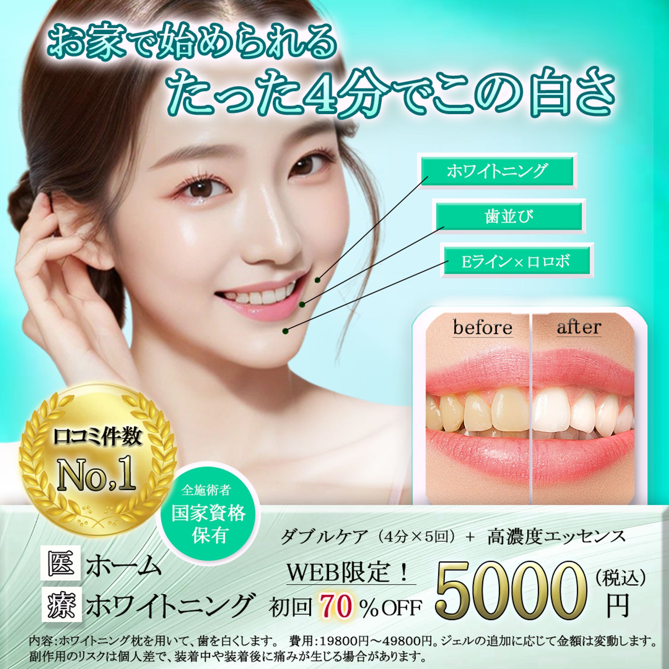 ホワイトニング-1