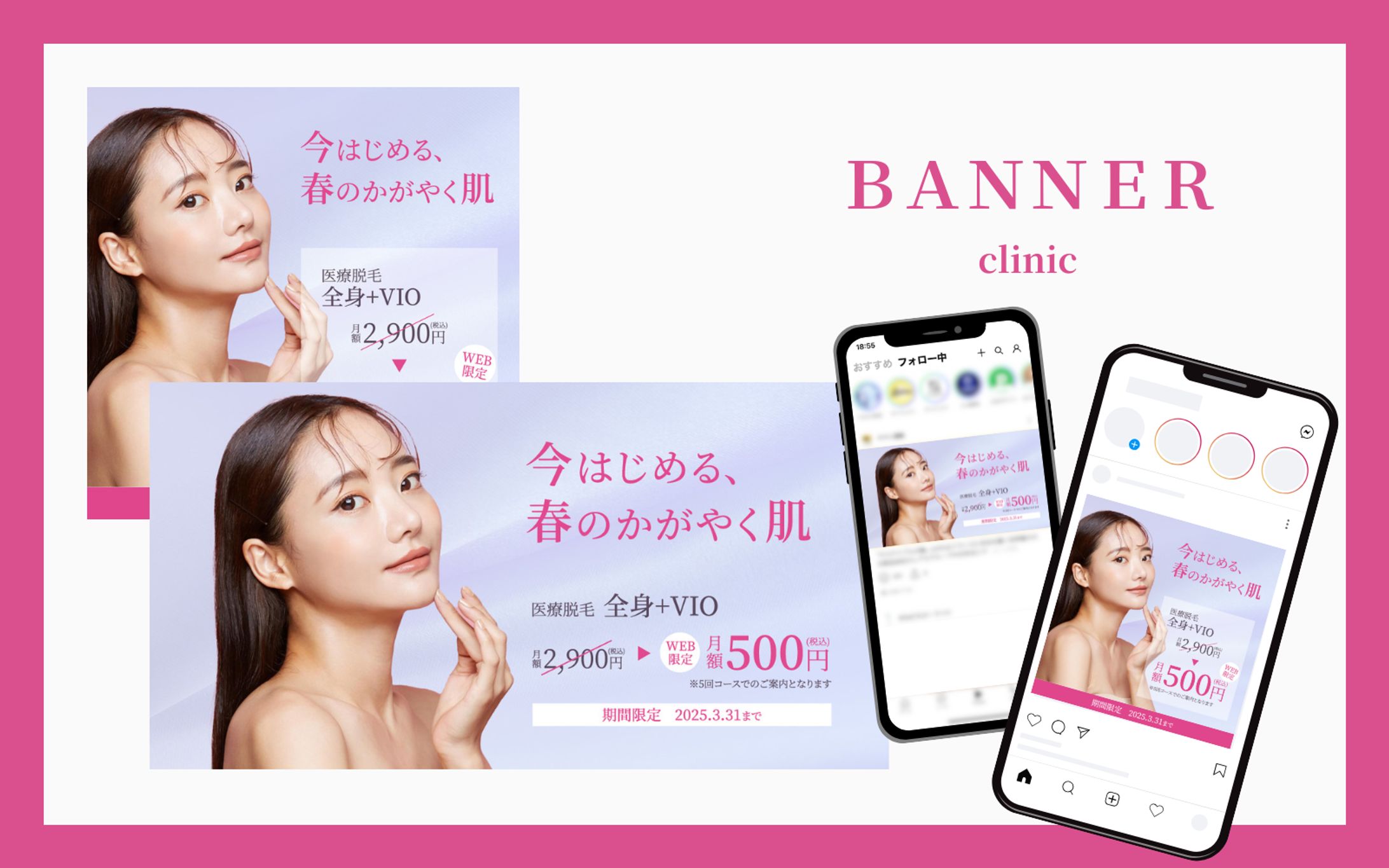 クリニック｜脱毛キャンペーンバナー-1