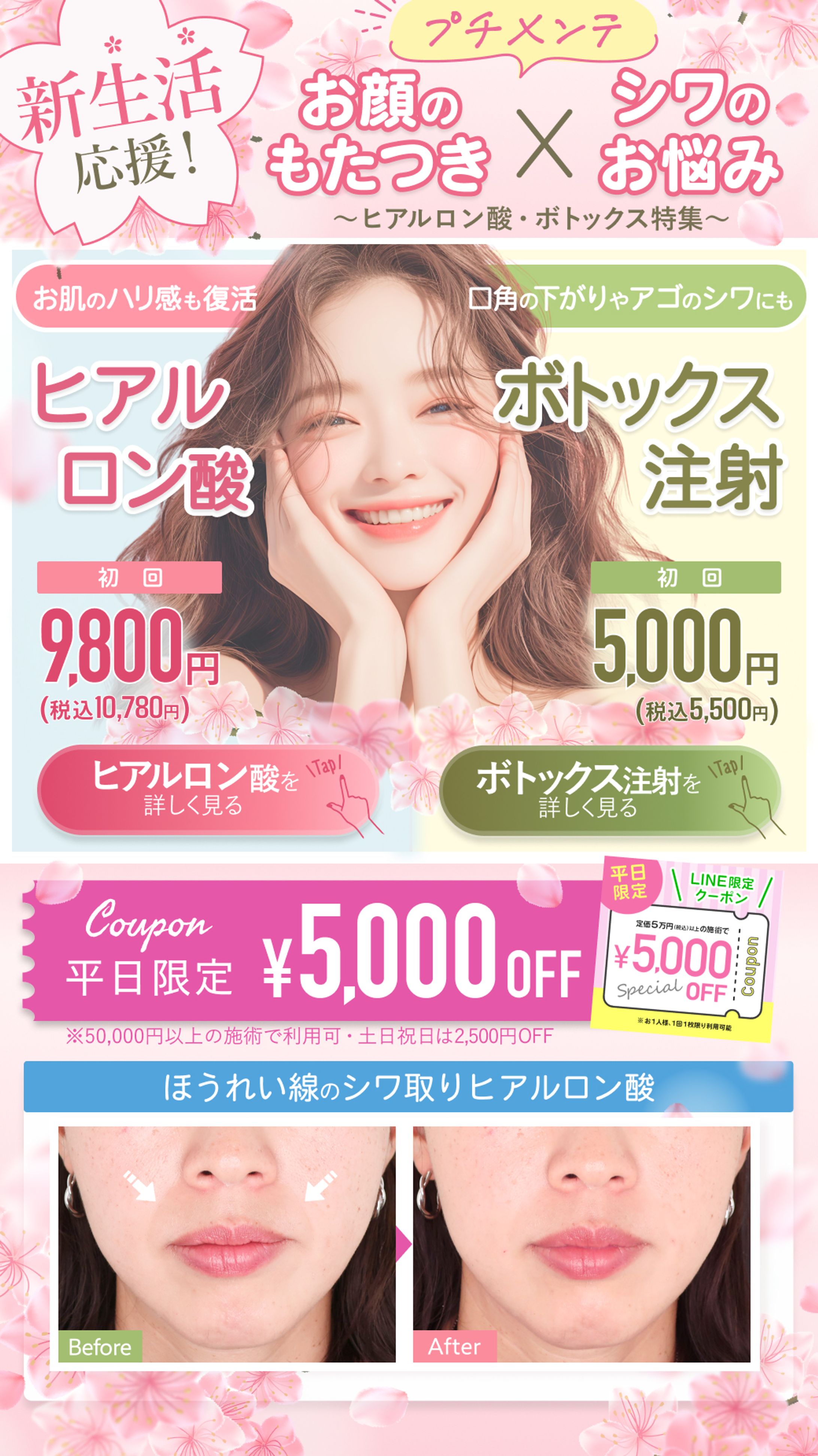 新生活応援　ヒアルロン酸とボトックス特集-1