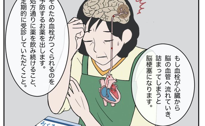 心房細動の治療