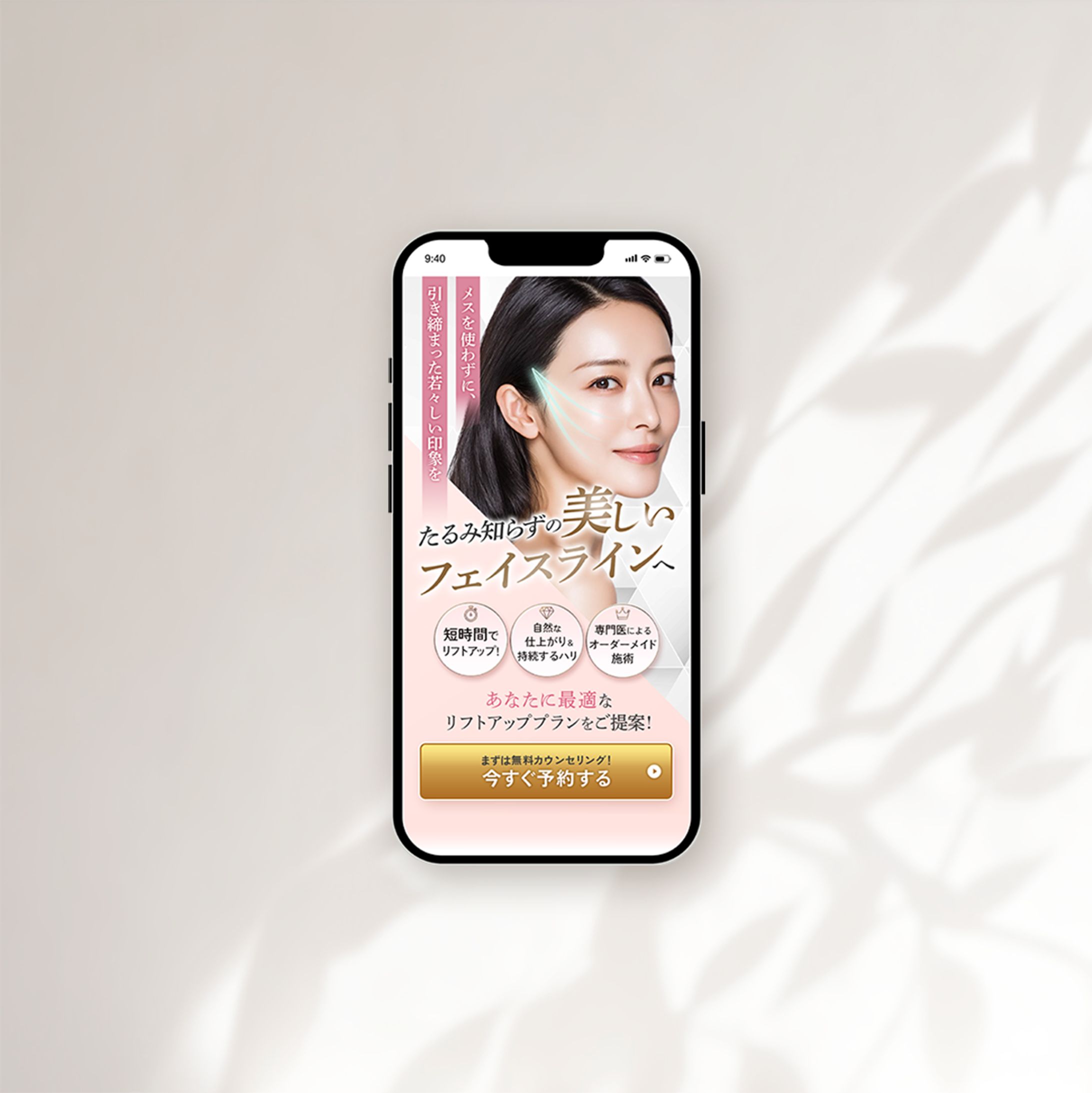 糸リフト女性向け　FV-1