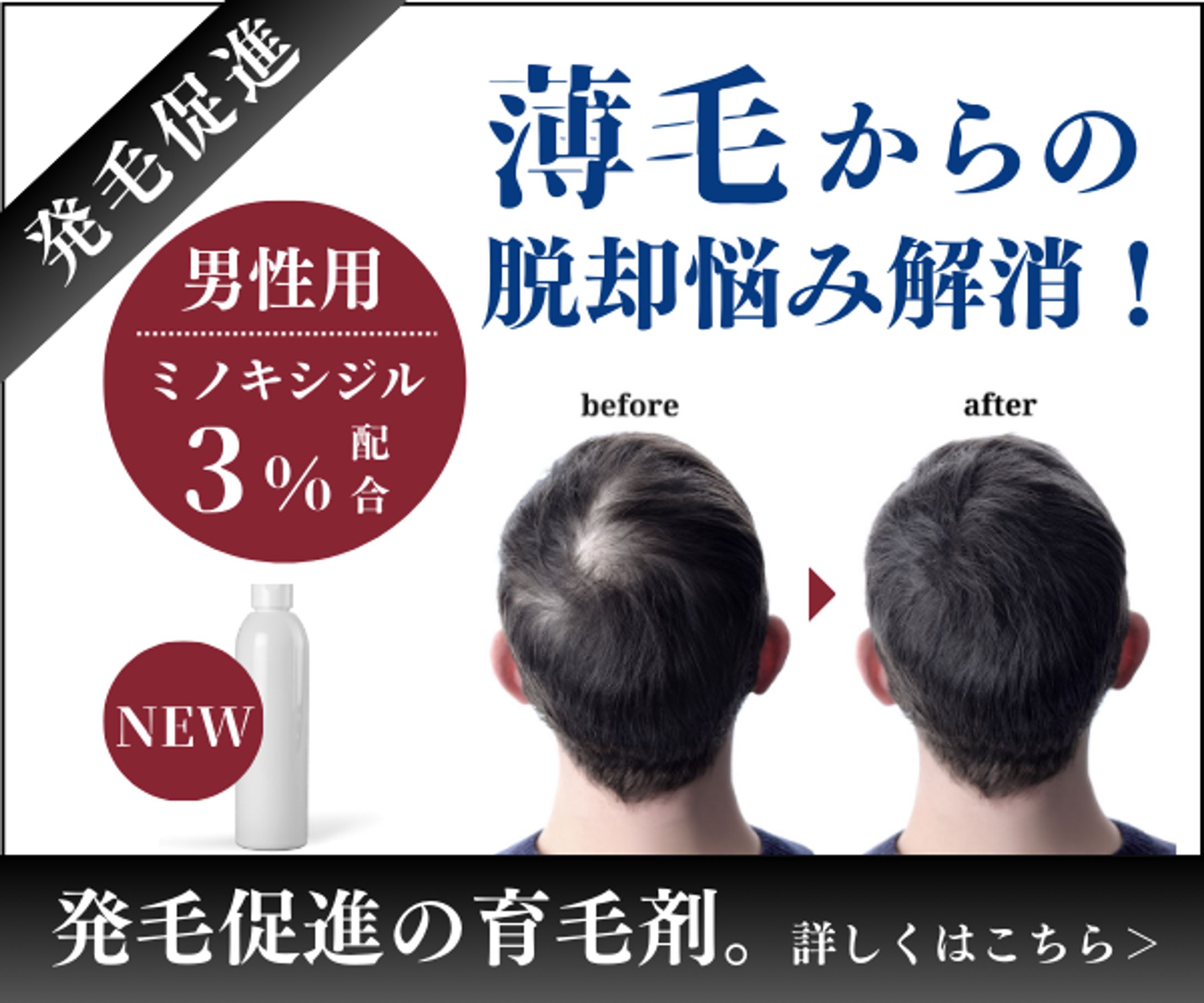 薄毛バナー-1