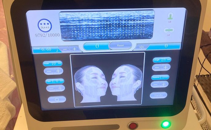 新メニュー用に
HIFUを(ウルセラタイプとVタイプ)を仕入れてきました。

フルで1時間10分
・ウルセラタイプ2層打ち
・Vタイプ3層打ち
・フォトフェイシャル
・仕上げにヒト幹細胞のエレクトロポレーション導入

<シミ、シワ、タルミ、むくみ、美白、美肌、ニキビ跡、肌質改善、産毛除去>

次の日以降の肌のハリも実感出来るので看板メニューとしても使えそうです♪
#GW中はエステティシャン
#7dhifu #7dhifuvmax #フォトフェイシャル #お約束のビフォーアフター #4dhifu #hifu #エレクトロポレーション導入 #ヒト幹細胞美容液 
#エステティシャン募集中 #新メニュー #mixfit