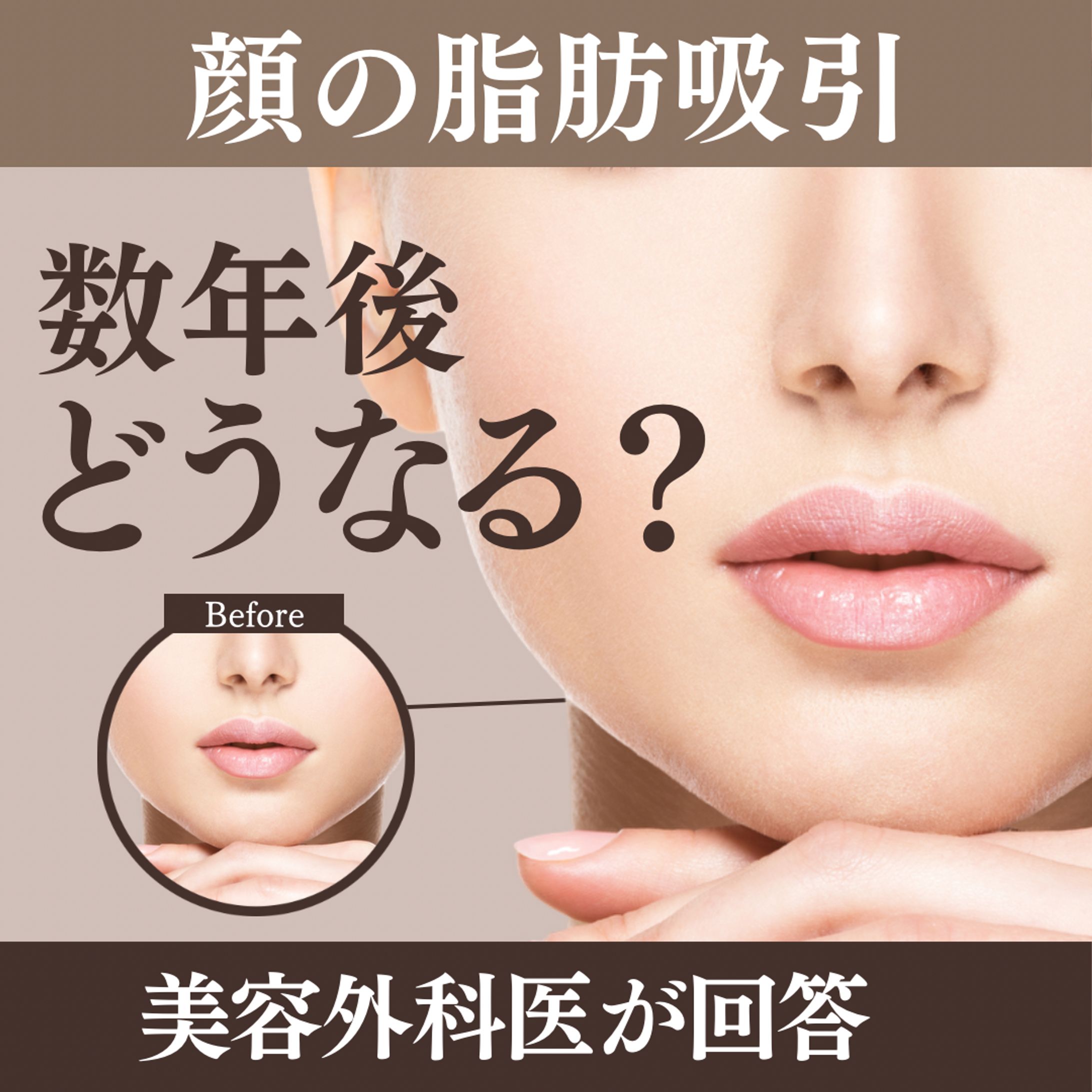 美容外科広告バナー-1