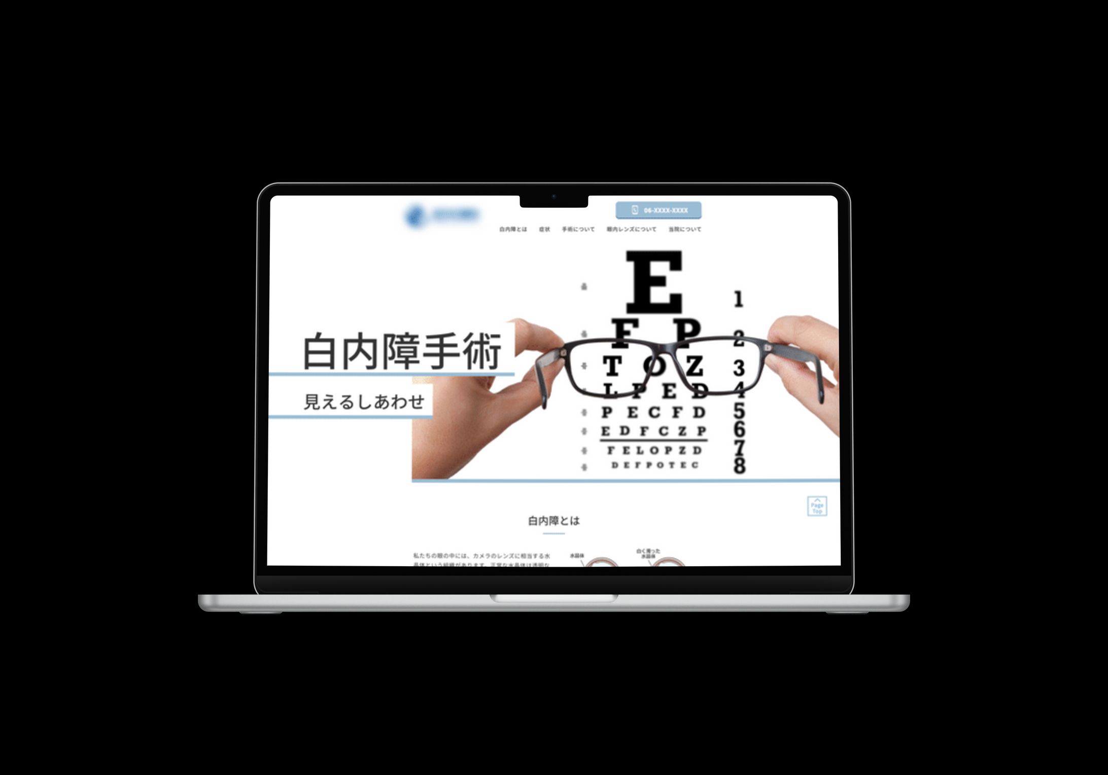 クリニックLP｜白内障手術について-1