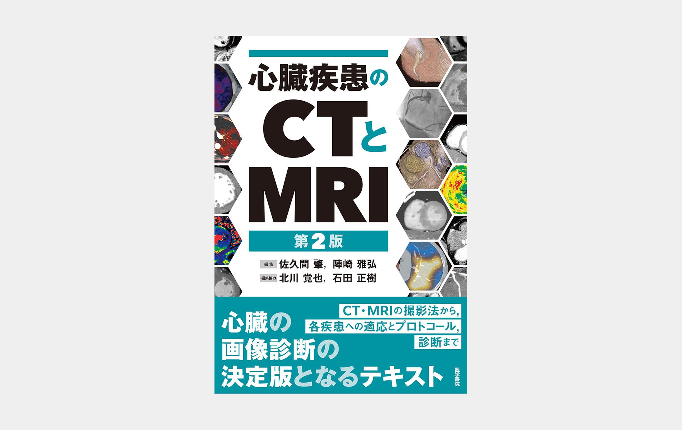 心臓疾患のCTとMRI 第2版-1