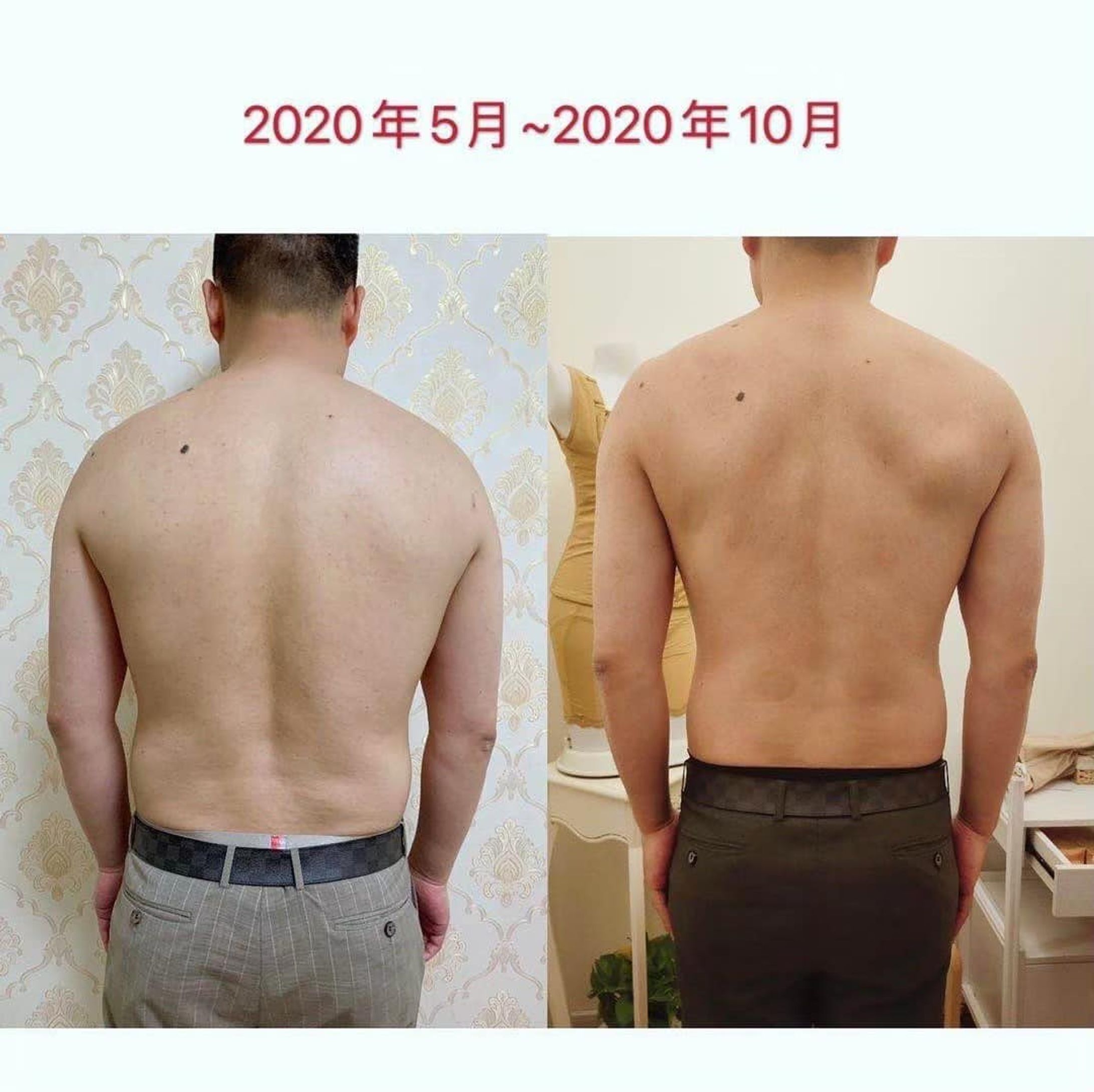 【男性】劇的ビフォーアフター-1