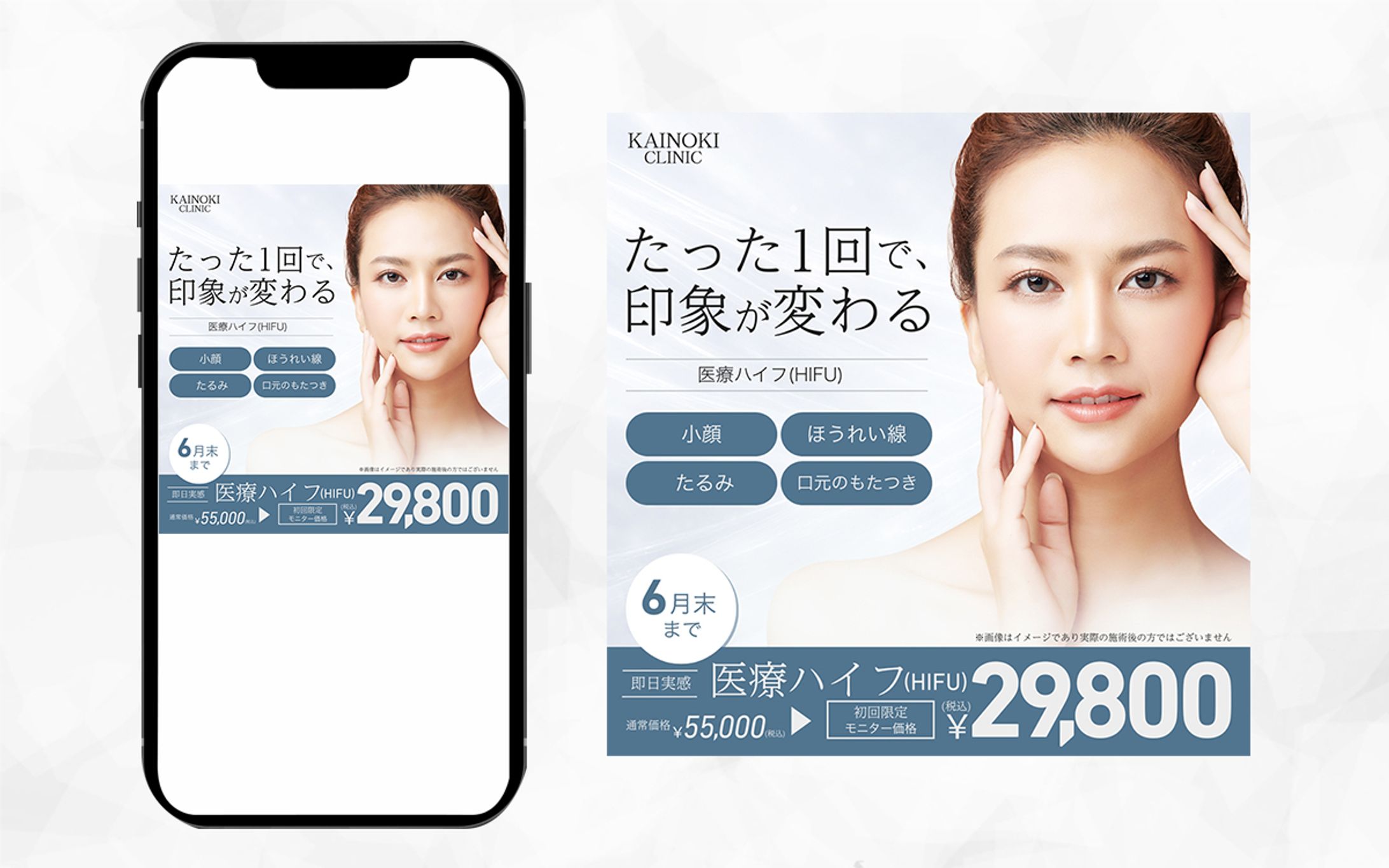 医療ハイフのバナー-1