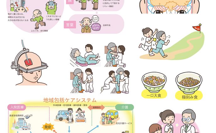 『脳卒中看護 3年目の教科書: 疾病・障害・生活の疑問をズバリ解決&フカボリ解説 (ブレインナーシング2020年夏季増刊)』挿絵
