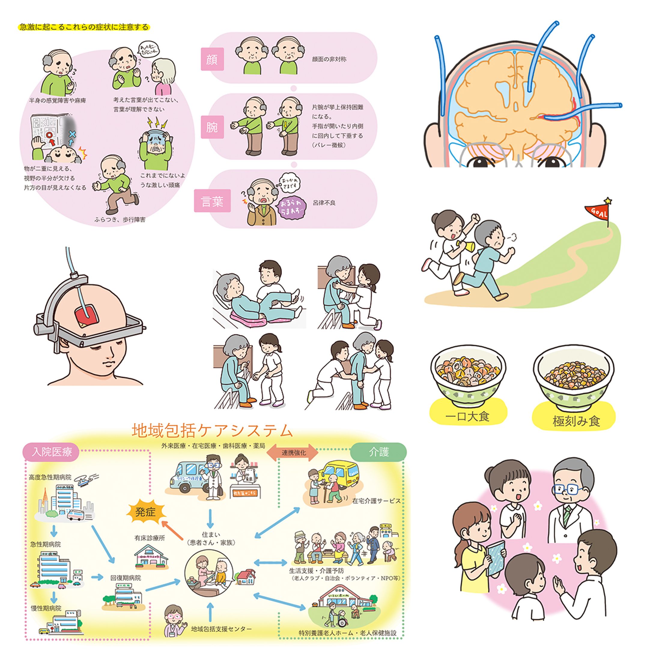 『脳卒中看護 3年目の教科書: 疾病・障害・生活の疑問をズバリ解決&フカボリ解説 (ブレインナーシング2020年夏季増刊)』挿絵-1