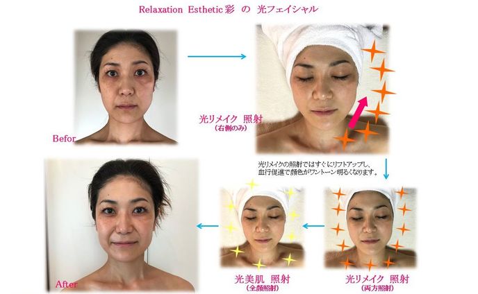 フェイシャルエステで即キレイに