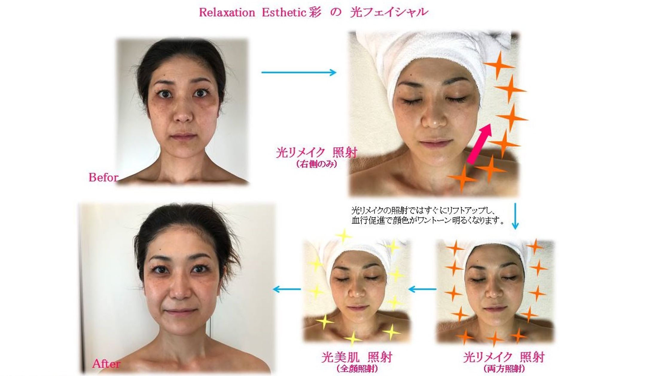 フェイシャルエステで即キレイに-1