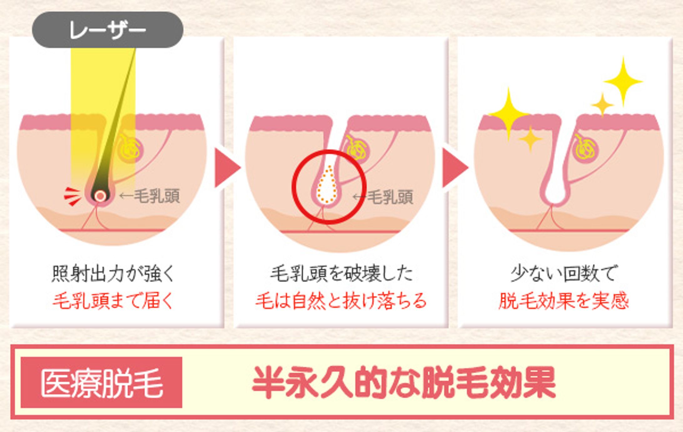 コンテンツ用 画像-1